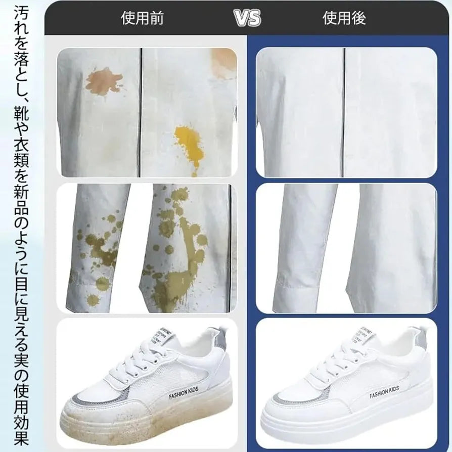 20Pcs Clothing Stain Removal Wipes